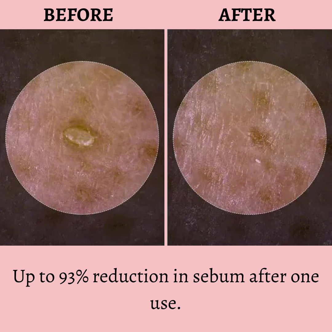 Cleanskin- Clearer skin without visible pores