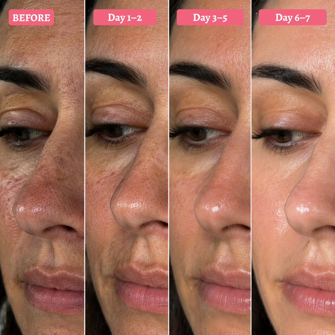 Cleanskin- Clearer skin without visible pores